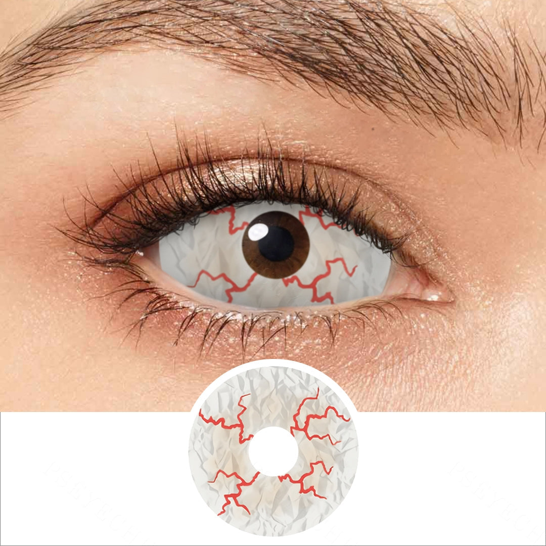 Sclera Blanco con venas